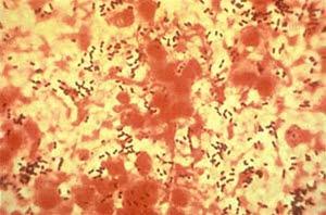 Pneumococci, microscope