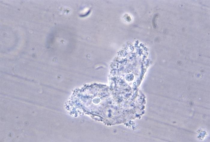 Vaginalceller dekket med bakterier. Fra US Centers for Disease Control and Prevention.