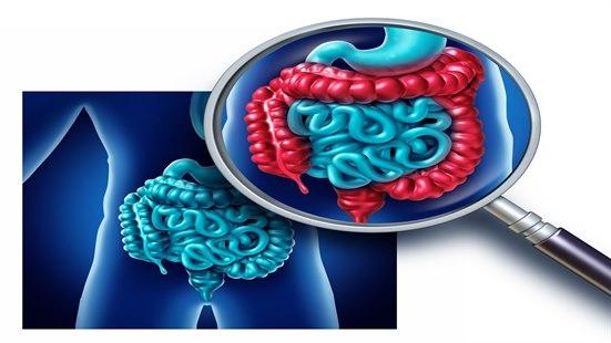 IBD