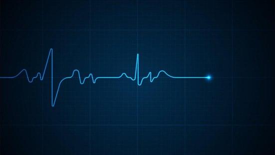 Illustrasjonsfoto av elektrokardiogram (EKG)