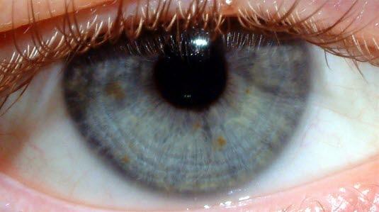 Eye