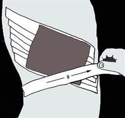 Ribbeinsteiping bilde#5