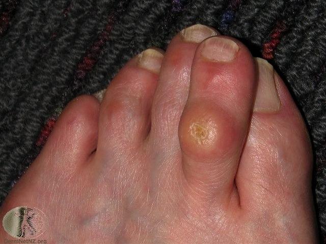 Fotoet viser clavus