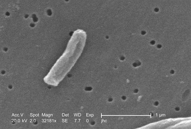 Foto: PHIL - Centers for Disease Control and Prevention. Elektonmikroskop viser 32181x forstørrelse av Mycobacterium tuberculosi, en gram positive stavbakterie. Bakterien er aerob og kan bare overleve i miljø med oksygen. Bakterien er omtrent 2-4µm lang og 0.2 - 0.5 bred