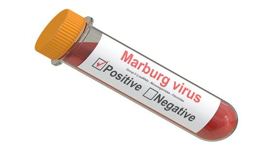 Bilde av prøveglass med blodprøve som viser positiv test på Marburg virus.