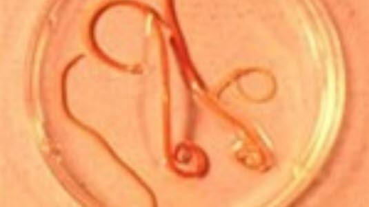 Ascariasis, spolorm