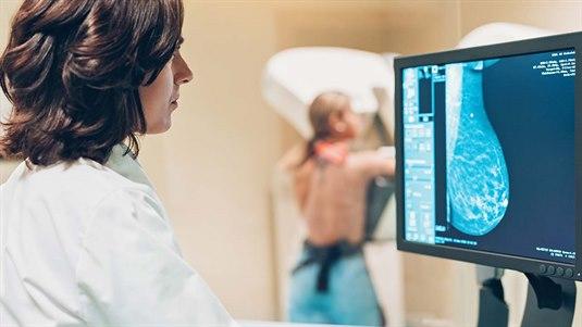 Lege utfører en mammografi på en kvinnelig pasient