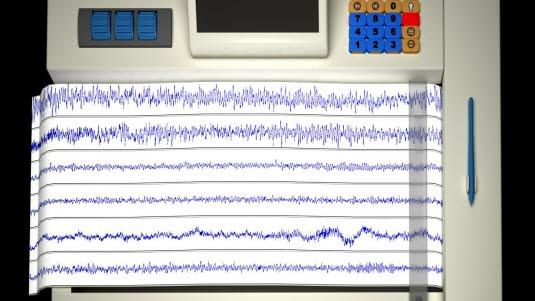 EEG