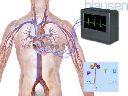 EKG