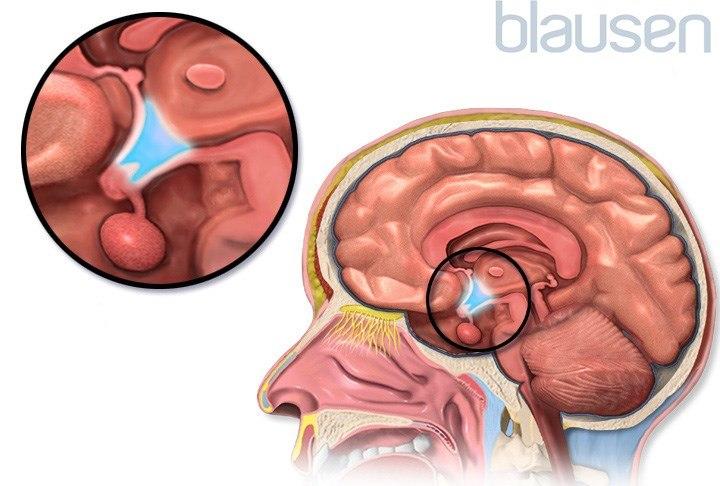 Hypothalamus