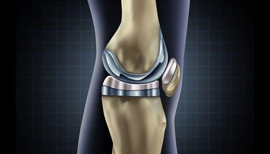 Kneprotese