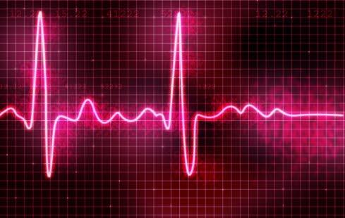 Unormalt EKG