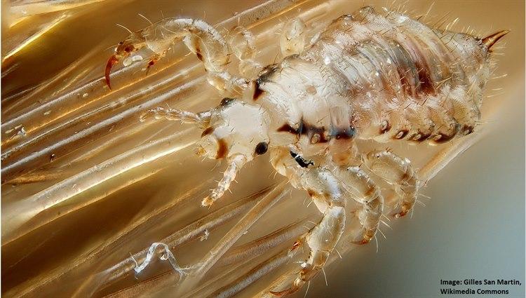 Male_human_head_louse.jpg