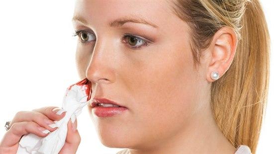 Illustrasjonsfoto av en kvinne som holder et papir mot nesen, med tegn til blod på papiret.