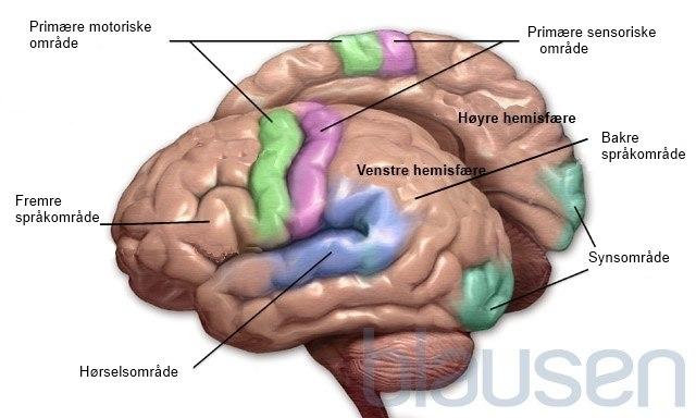 Epilepsi bilde#2