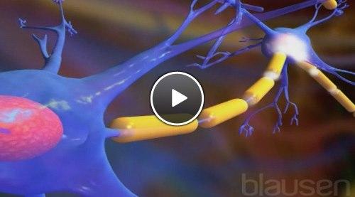 epilepsi