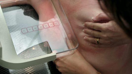 mammography