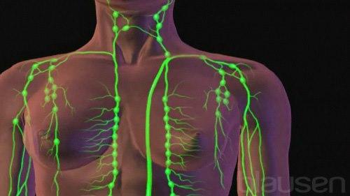 Illustrasjon viser hals og overkropp med inntegnet lymfeknutestasjoner og lymfeårer.