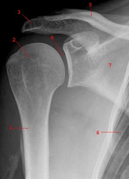 Skulder, front
