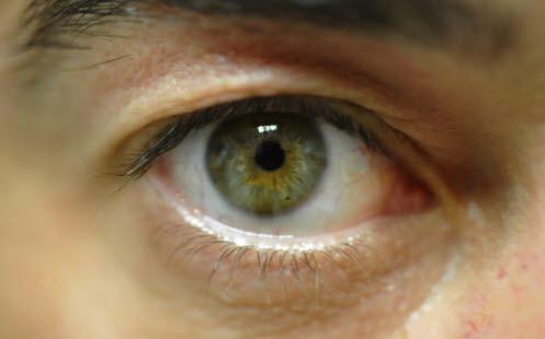 Eye