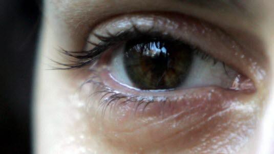 Red eye