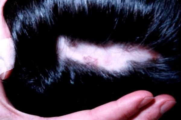 Fotoet viser Alopecia areata i hodebunnen til en mann