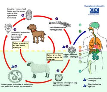 Echinococcus