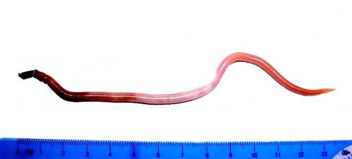 Ascaris lumbricoides - NHI.no