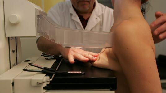 mammography