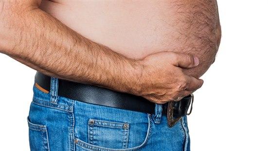 Overweight man