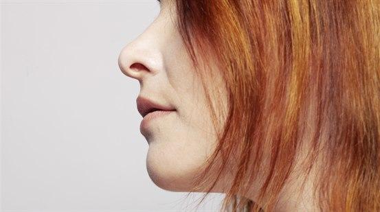 botox