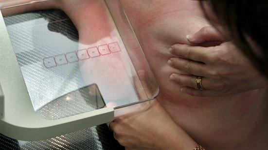 Illustrasjonsfoto som viser nærbilde av et bryst i mammografiapparatet.
