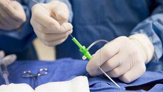 Koronar angioplastikk