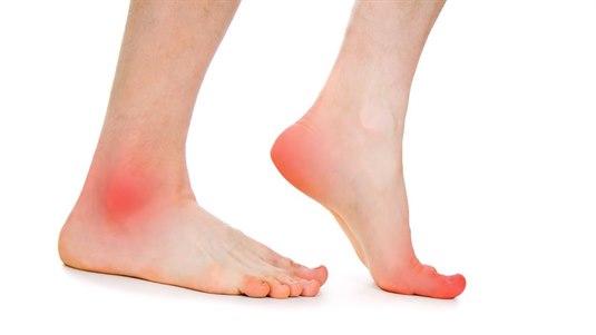 Gout localisations