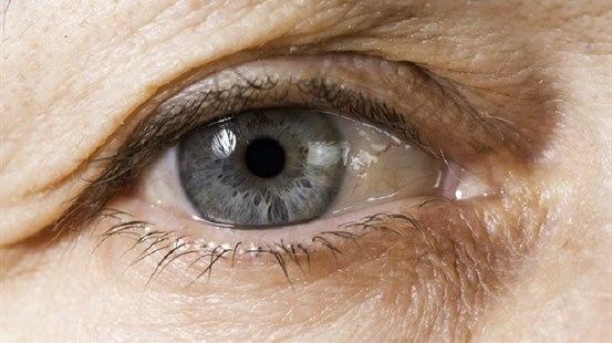 Illustrasjonsfotoet viser viser et øye med pingvekula på nasalsiden