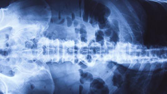 Røntgen oversikt av bukhulen