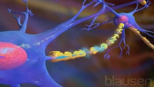 Multipple sclerosis