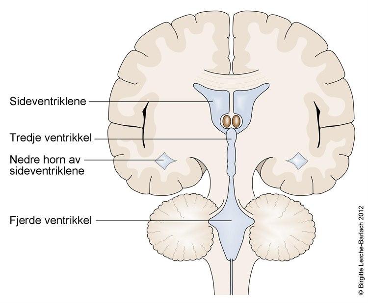 Hjernens ventrikkelsystem, tverrsnitt