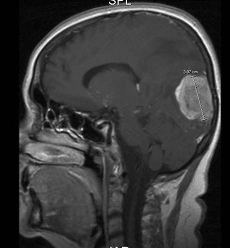 Foto: Radiologisk avdeling, UNN