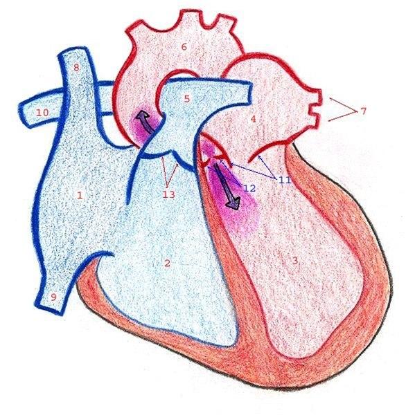 Aorta insufficiens