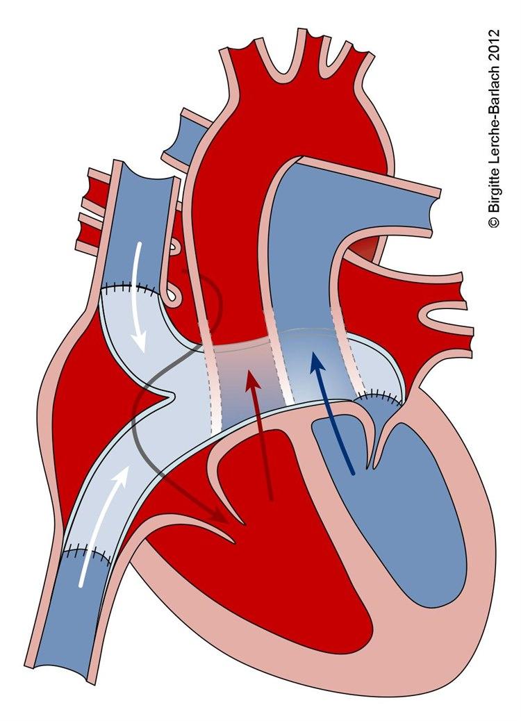 7702-6-lh-id675-2-transpositio-vas.jpg