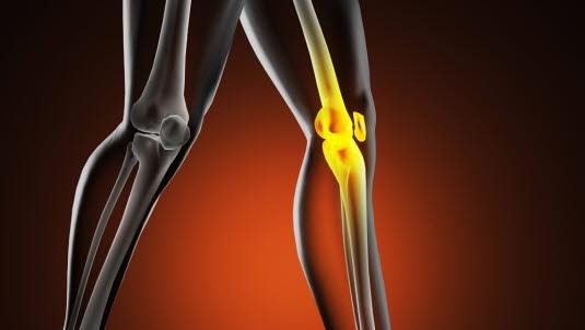 Illustrasjonsfotoet viser et animasjonsbilde av to ben der venstre knee lyser opp gult i kneregionen