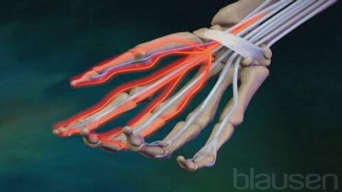 Illustrasjonen viser skjelettet av en høyre hånd som peker med håndflaten oppover. Det er tegnet inn det transverse karpalligamentet og noen fleksorsener. Nervus medianus er tegnet i rød farge med forgreninger til fingrene 1-3.